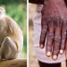 CONFIRMADO: América do Sul registra primeiro caso da varíola do macaco
