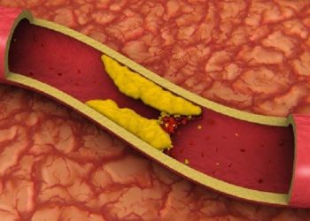Dia Nacional de Prevenção e Controle do Colesterol: Cuidando da Saúde Cardiovascular através da Nutrição Consciente