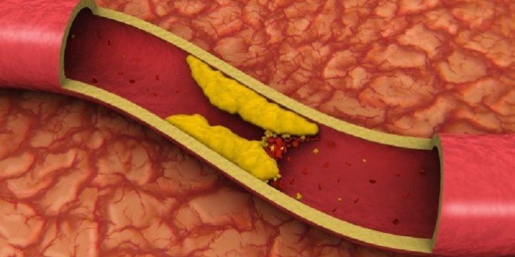 Dia Nacional de Prevenção e Controle do Colesterol: Cuidando da Saúde Cardiovascular através da Nutrição Consciente